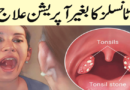 Tonsils Explained: Discover Natural Home Remedies for Tonsil Relief