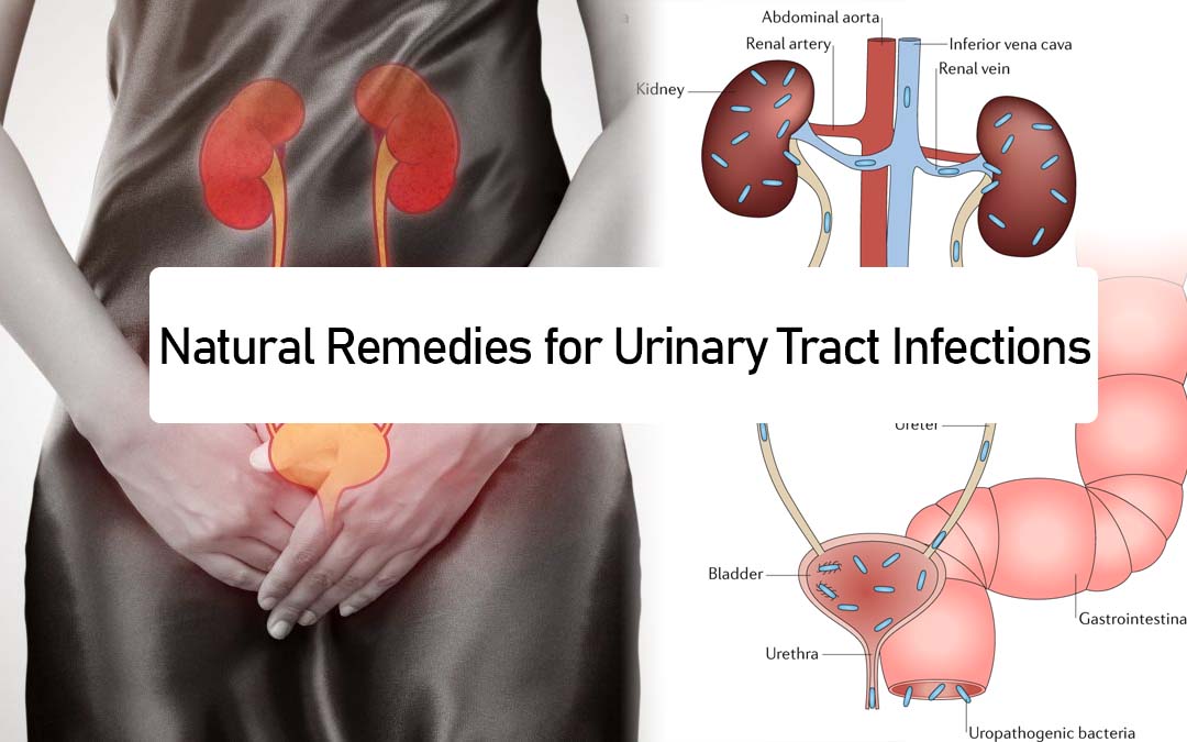 Effective Natural Remedies for Urinary Tract Infections ThePakistanToday