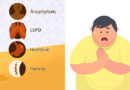 Easy Breathing Tips for Obesity-Related Shortness of Breath